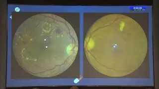 AIOC2022 FP1637    Community   Semi Final topic TRASH TO TREASURE RETCAM  TREASURE TO SAVE SIGHT AMI
