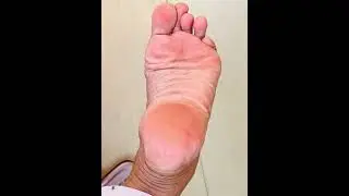 Cute Feet ✨ #feetmassage #feet #cute 