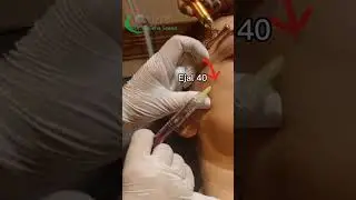 Mesoheal Ejal 40 Italian Skin Booster! اپنی جلد کو دوبارہ جوان بنائیں #enhancebydrwajieha #ytshorts