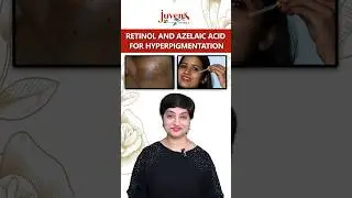 Retinol and Azelaic Acid For Hyperpigmentation ! #Hyperpigmentation #Retinol #azelaicacid #selfcare