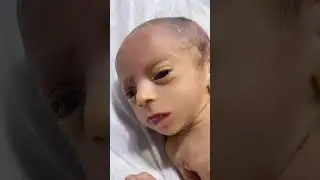 Precious Little Baby 👶💕 Cutest Moments Ever | Adorable Newborn #PreciousBaby #AdorableBaby