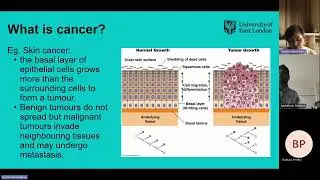 How does a degree at the UEL Biosciences department help you understand & work on treating cancer?