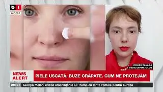 VIVIANA DĂNĂILĂ, MEDIC DERMATOLOG, DESPRE SEZONUL RECE ȘI EFECTELE ASUPRA PIELII_Știri B1TV_19 ian.