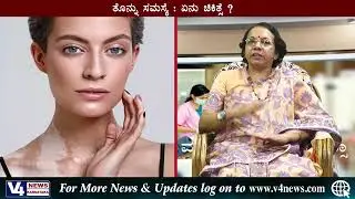 KANACHUR HOSPITAL & RESEARCH CENTRE | AROGYA VANI | DISCUSSION WITH DR SHRUTHA KEERTHI | vitiligo