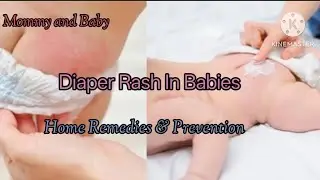 Diaper Rash In Babies //Home Remedies for Diaper Rash