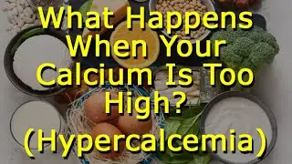 What Happens When Your Calcium Is Too High?