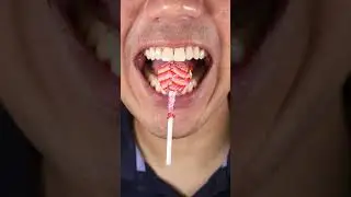 ASMR Chupa Chups Lollipop | Enchanting Strawberry Vanilla Flavor #DoctorTristanPeh #ASMR #Lollipop