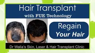 Dr Walia's Skin, Laser & Hair Transplant Clinic I Trailer