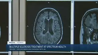 Medical Moment: Multiple Sclerosis