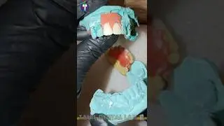 🥶2Teeth Wax up & Teeth Setting🦷😁|🎯Dental Office Acrylic Lab Work🧑&zwj;🎨| Tamil Dental Lab | #artandcraft