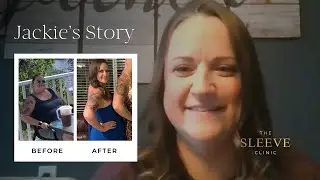Jackie’s Bariatric Surgery Success After Losing 80 lbs with The Sleeve Clinic