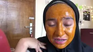 PEJUANG JERAWAT Eps.03 I MASKER Kunyit dan Madu