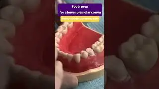 Tooth Prep for Lower Premolar Crown 🦷 | Tools Top Dentists Use in the Middle East 🔍🇦🇪📄