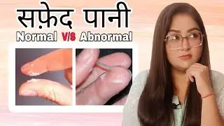 Normal Vs Abnormal White Discharge | पूरा पक्का इलाज | सफेद पानी | White Discharge By Dr. Vanshika