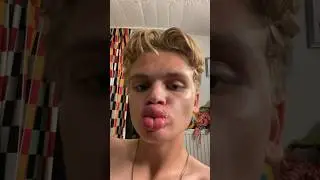 kylie jenner lip challenge 😍 wow very big