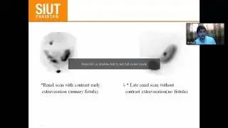 MS Urology Online Presentations:Transplantation &ndash; Surgical  Complications