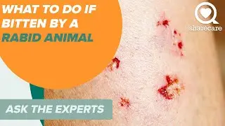What to Do if Bitten by a Rabid Animal | Ask the Experts | Sharecare