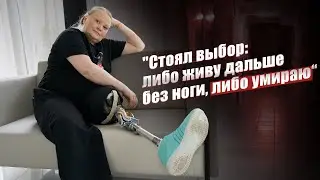 Ампутация. Оказалось это не так страшно: Светлана | История пациента INSTEP