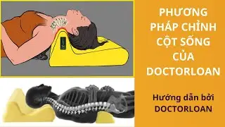 CỘT SỐNG KHỎE - Phương ph&aacute;p chỉnh cột sống của DOCTORLOAN
