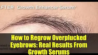 How to Regrow Overplucked Eyebrows: Real Results From Growth Serums