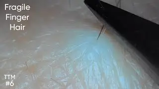 Hairs on the Finger Can Be Fragile and Frustrating | Tweeze & Pluck | 50x Zoom Close-up #6