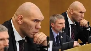 El Hombre Con La CABEZA Más Grande Del Planeta.