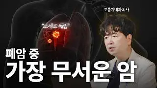 증상이 없는, 소리 없는 살인마 폐암! 특히, 소세포 폐암은 더욱 잔인합니다.