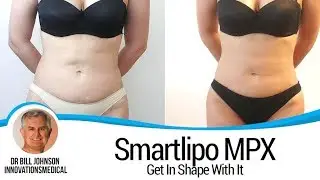 Get In Shape with Smartlipo MPX - 2010