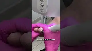 Сложные случаи в педикюре требуют от мастера особой подготовки.