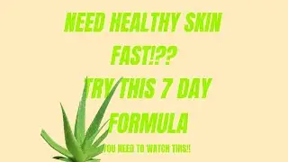 Aloe Vera for Acne: Tips and Tricks for Clearer Skin