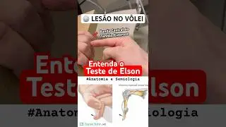 Enetenda o Teste de Elson com Anatomia #Semiologia #ortopedia