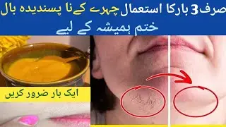 DIY Unwanted Hair Removal Cream At Home | NO WAX NO PAIN | Get rid of full body hair Chest, Arms Leg