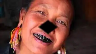 Teeth Blackening Taboo