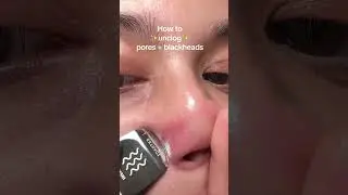 #pores #blackheadremoval #skincare #skincareroutine