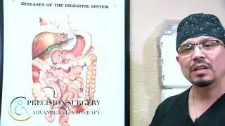 GALLBLADDER surgery