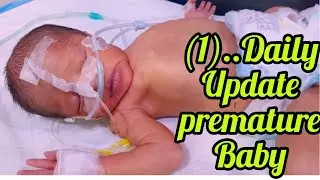 Premature Newborn in NICU |Intensive Oxygen Support & Care#DailyUpdate#👈🏻🚨🕕4:00 critical condition😪🩺