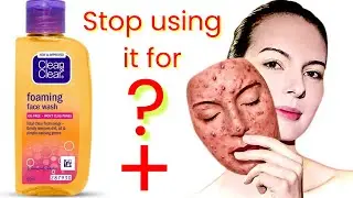Clean & Clear Face Wash:  Reality Check 🤯 Kya Clean & Clear se Pimple badhte hain? Stop using it! 🚫