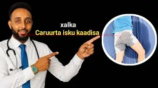 Sida ugu fudud loo daweyo ilmaha isku kaadiyo habeenki  1080p