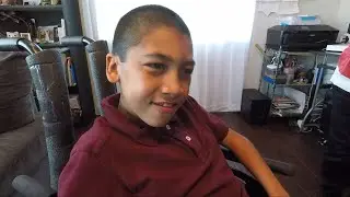 San Diego Child Only Known Person In World With This Rare Form Of Disease