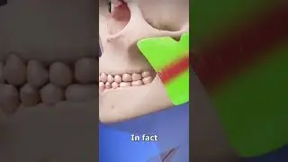 Power of masseter muscle #anatomymadeeasy #anatomy