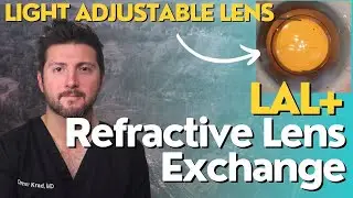 Refractive Lens Exchange (RLE) Surgery with the Light Adjustable Lens PLUS [Unedited]
