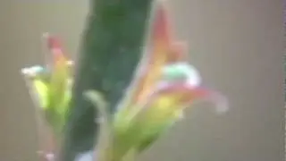Meiboscopy / meibography basic Introduction