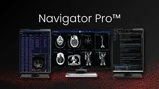 RapidAI | Rapid Navigator Pro&trade;| Deep clinical AI for triage, workflow, and reporting in radiology