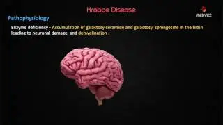 Krabbe Disease - Usmle Biochemistry Webinar based Lecture