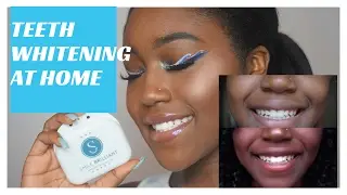 HOW I WHITENED MY TEETH AT HOME + GIVEAWAY!