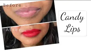 #candylips /candylips / lip pigmentation / semi permanent lip tint for African skin / #africanskin