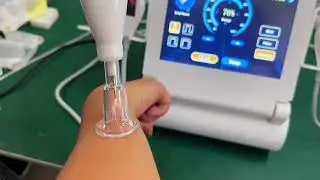 🔥 Cold Plasma Pen in Action! 🔥#plasma #plasmatraining #plasmapen #plasmalift #beauty  #coldplasma 