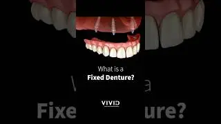 Why Dentists Recommend This Denture Over All Others
