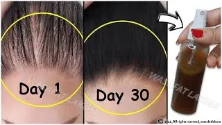 30 Days Summer Hair Growth Challenge,🌿Regrow Lost Hair, Get Double Density and Thick Hair