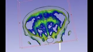 Mice Brain MicroCT slice with volume rendering